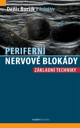 Periferní nervové blokády - Základní techniky - 